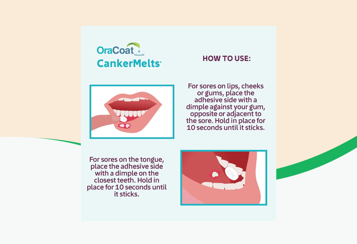 OraCoat CankerMelts, 20 ct.