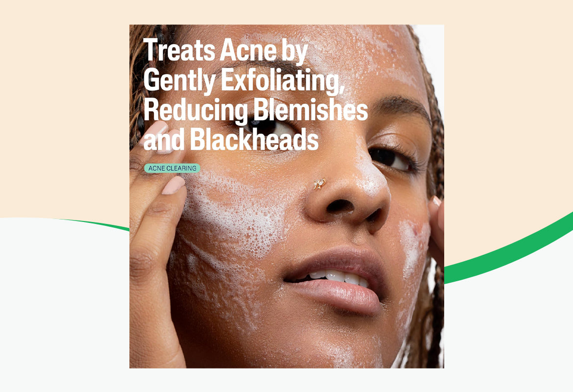 Cetaphil Gentle Clear Pore Clearing Acne Cleanser, 8 oz.